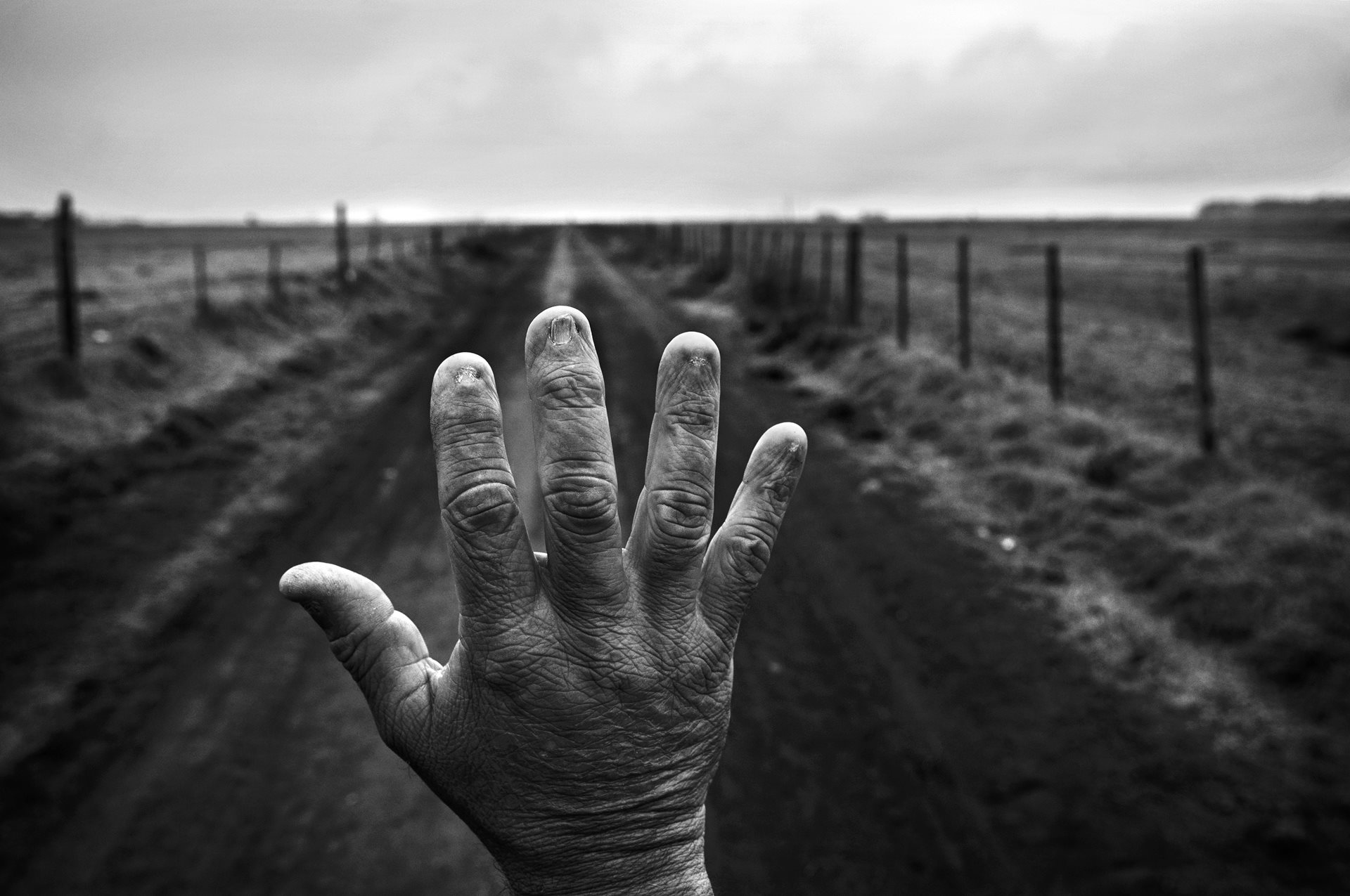 Former land applicator Alfredo Cerán shows his burned fingernails. After years of mixing up to seven chemical products at once without adequate protection, he developed non-alcoholic cirrhosis and underwent a liver transplant. In his hometown of Monte Maiz, cancer death rates reached 55% in 2014. Cordoba, Argentina.